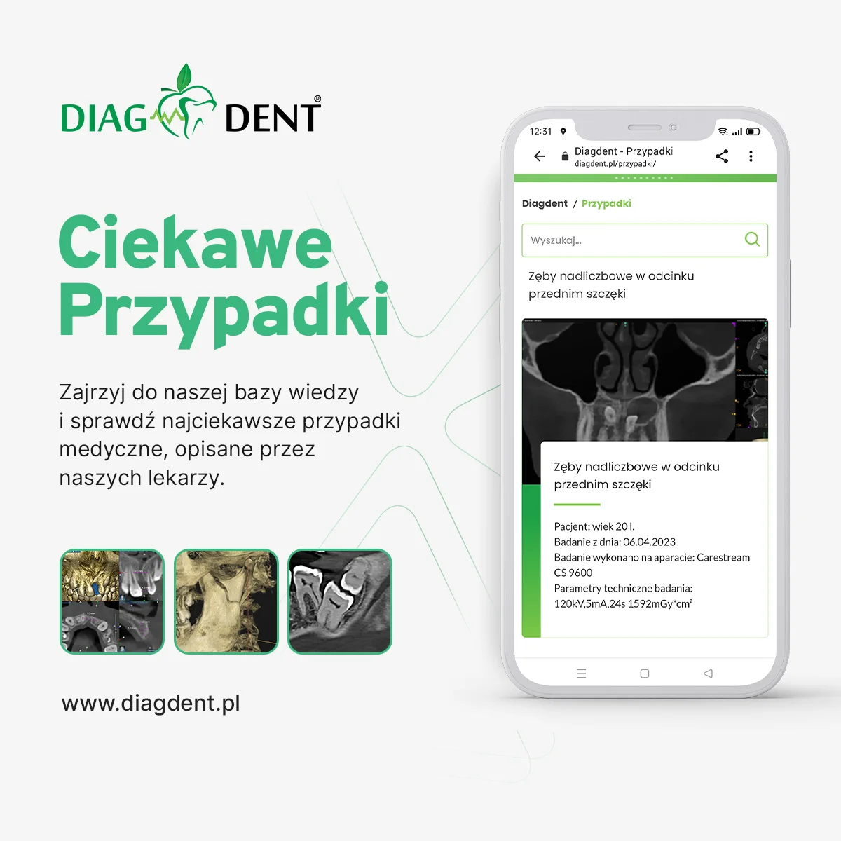 Kampania marki Diagdent na stronie i w social mediach